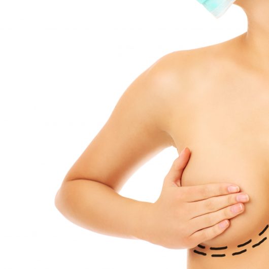 Implant mamar interventie